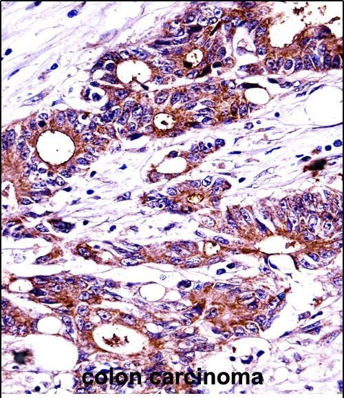 NPM1 Antibody in Immunohistochemistry (Paraffin) (IHC (P))