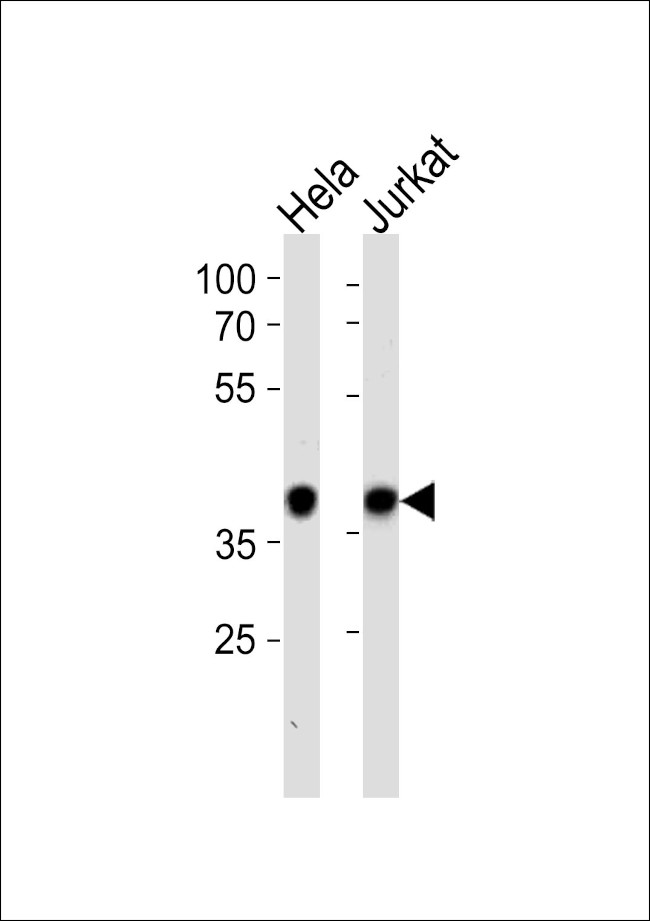 NPM1 Antibody in Western Blot (WB)