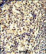 SNRPD1 Antibody in Immunohistochemistry (Paraffin) (IHC (P))