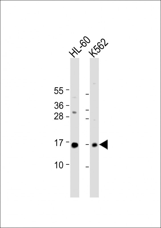 SNRPD1 Antibody in Western Blot (WB)