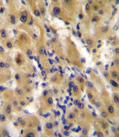 ENPP2 Antibody in Immunohistochemistry (Paraffin) (IHC (P))