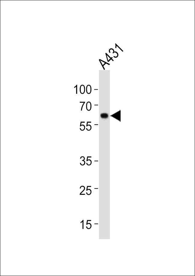 HSP60 Antibody in Western Blot (WB)