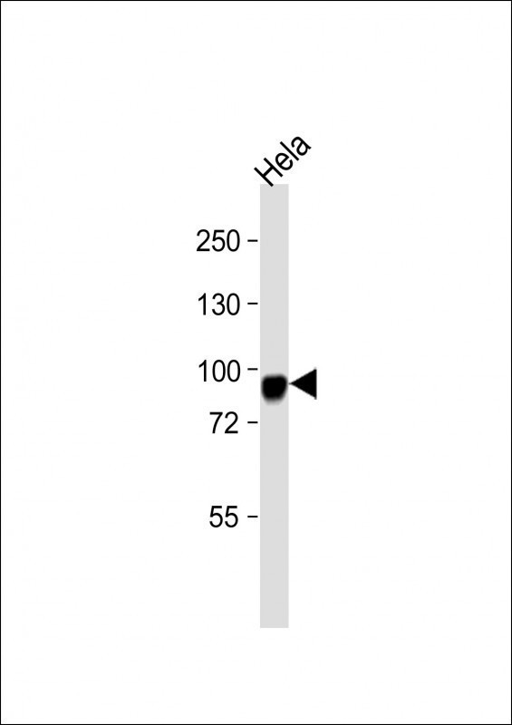 CD105 Antibody in Western Blot (WB)