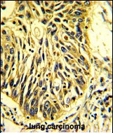 EPCR Antibody in Immunohistochemistry (Paraffin) (IHC (P))