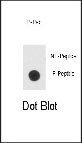 Phospho-BAD (Ser99) Antibody in Dot Blot (DB)