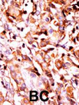 Phospho-BAD (Ser99) Antibody in Immunohistochemistry (Paraffin) (IHC (P))