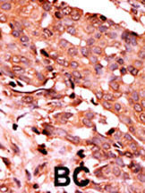 Phospho-Caspase 6 (Ser257) Antibody in Immunohistochemistry (Paraffin) (IHC (P))