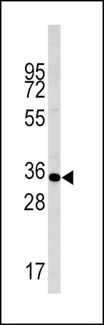 Phospho-Caspase 6 (Ser257) Antibody in Western Blot (WB)