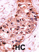 Phospho-Caspase 9 (Ser196) Antibody in Immunohistochemistry (Paraffin) (IHC (P))