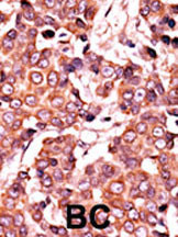 Phospho-Cdc25A (Ser278) Antibody in Immunohistochemistry (Paraffin) (IHC (P))