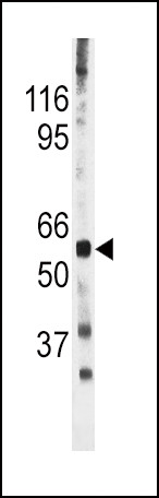 Phospho-Cdc25A (Ser278) Antibody in Western Blot (WB)