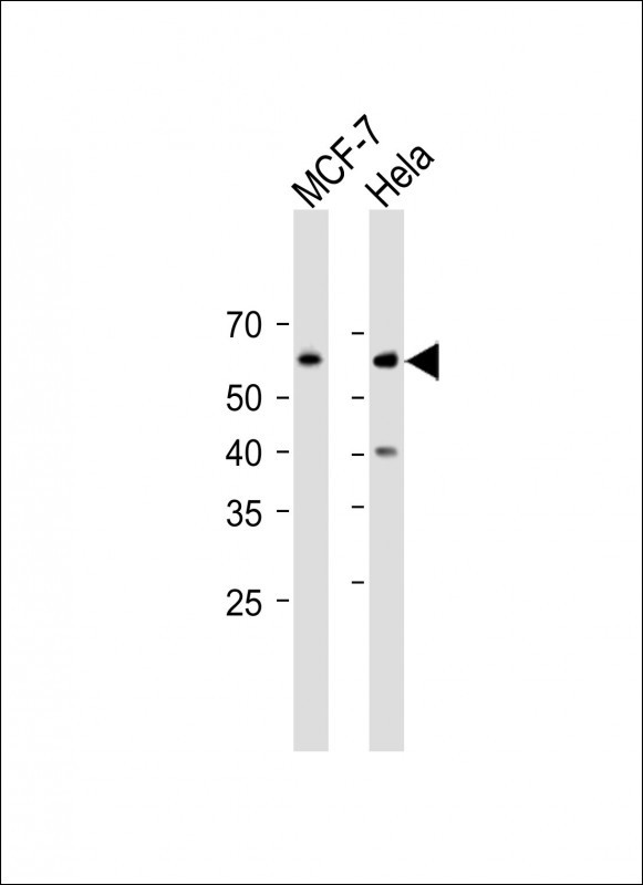 Phospho-Cdc25A (Ser293) Antibody in Western Blot (WB)