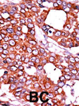 Phospho-Cdc25A (Thr507) Antibody in Immunohistochemistry (Paraffin) (IHC (P))