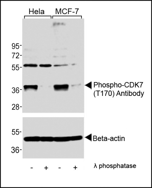 Phospho-CDK7 (Thr170) Antibody in Western Blot (WB)