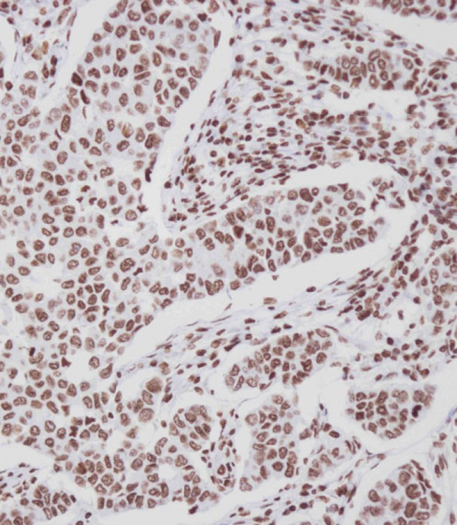 Phospho-ErbB4 (Tyr1188) Antibody in Immunohistochemistry (Paraffin) (IHC (P))