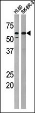 Phospho-PKMYT1 (Thr495) Antibody in Western Blot (WB)