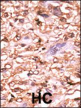 Phospho-p53 (Thr18) Antibody in Immunohistochemistry (Paraffin) (IHC (P))