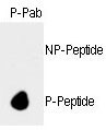 Phospho-Rb (Ser788) Antibody in Dot Blot (DB)