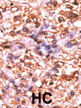 Phospho-Rb (Ser788) Antibody in Immunohistochemistry (Paraffin) (IHC (P))