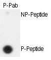 Phospho-Separase (Ser1126) Antibody in Dot Blot (DB)