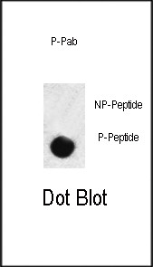 Phospho-SMAD3 (Ser208) Antibody in Dot Blot (DB)