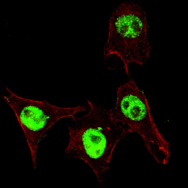 Phospho-SMAD3 (Ser208) Antibody in Immunocytochemistry (ICC/IF)