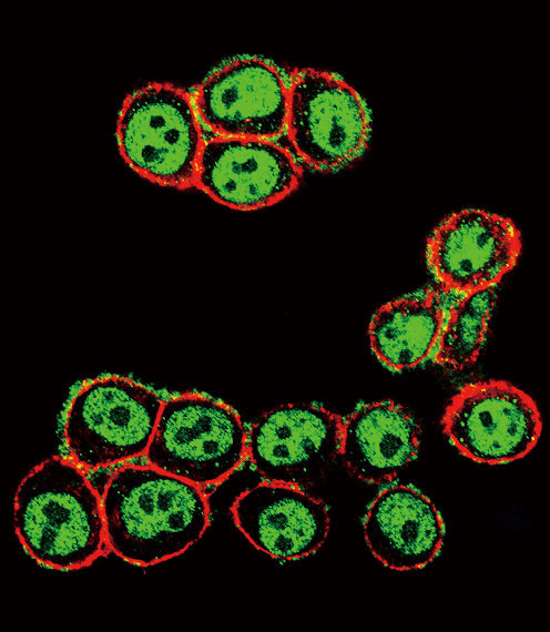 Phospho-SMAD3 (Ser208) Antibody in Immunocytochemistry (ICC/IF)