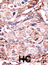 Phospho-SMAD3 (Ser213) Antibody in Immunohistochemistry (Paraffin) (IHC (P))