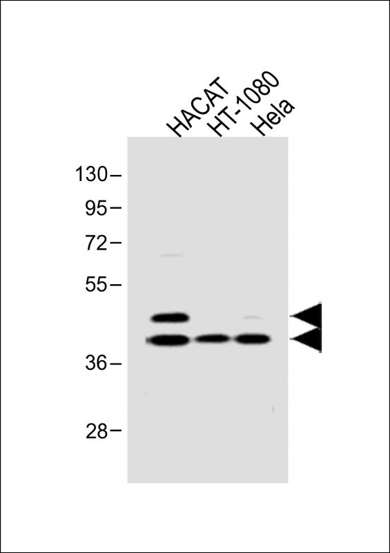 Phospho-SMAD3 (Ser213) Antibody in Western Blot (WB)