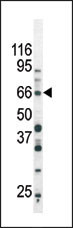 Phospho-SMAD3 (Ser213) Antibody in Western Blot (WB)