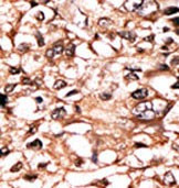 Phospho-TNFR1 (Ser274) Antibody in Immunohistochemistry (Paraffin) (IHC (P))