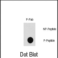 Phospho-TAK1 (Thr187) Antibody in Dot Blot (DB)