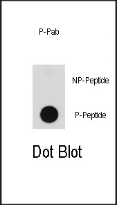 Phospho-B-Raf (Thr598) Antibody in Dot Blot (DB)