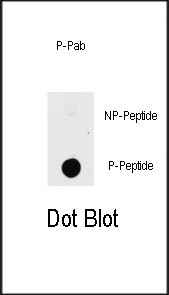 Phospho-PAK1 (Thr423) Antibody in Dot Blot (DB)