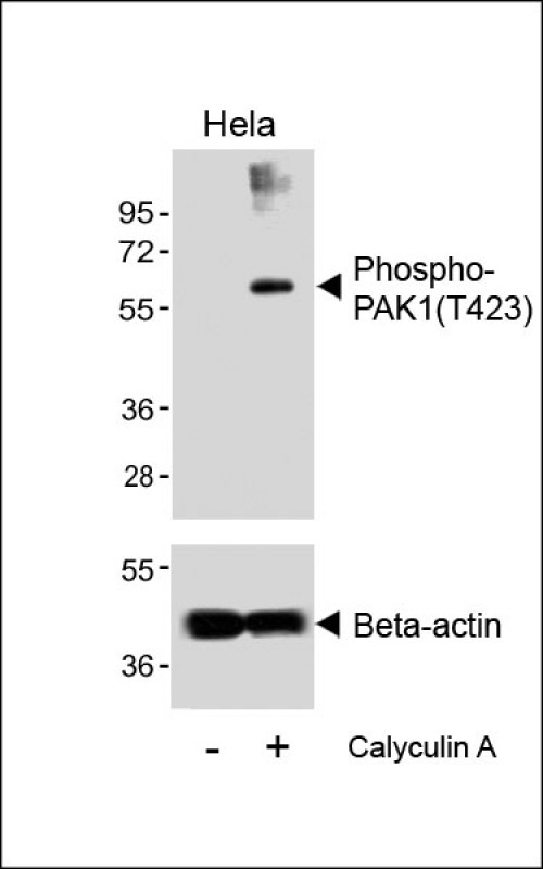 Phospho-PAK1 (Thr423) Antibody in Western Blot (WB)