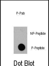 Phospho-4EBP1 (Thr36) Antibody in Dot Blot (DB)