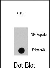 Phospho-c-Raf (Ser494) Antibody in Dot Blot (DB)