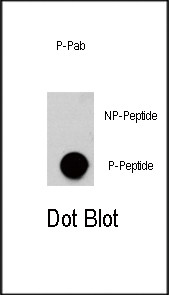 Phospho-AKT3 (Ser472) Antibody in Dot Blot (DB)