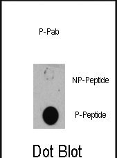 Phospho-TSC1 (Ser505) Antibody in Dot Blot (DB)