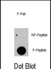Phospho-c-Raf (Tyr341) Antibody in Dot Blot (DB)
