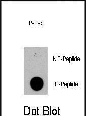 Phospho-TSC2 (Ser1420) Antibody in Dot Blot (DB)