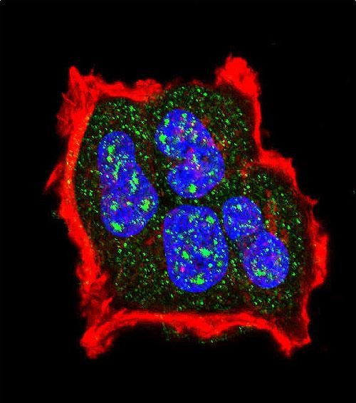 Phospho-TSC2 (Ser1420) Antibody in Immunocytochemistry (ICC/IF)