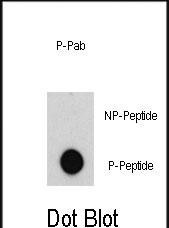 Phospho-c-Abl (Tyr185) Antibody in Dot Blot (DB)