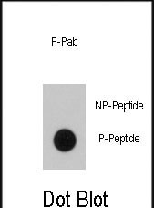 Phospho-B-Raf (Thr400) Antibody in Dot Blot (DB)