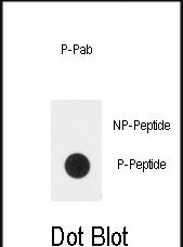 Phospho-PLXND1 (Tyr1642) Antibody in Dot Blot (DB)