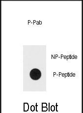 Phospho-ERK1 (Thr202, Tyr205) Antibody in Dot Blot (DB)