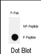 Phospho-HIPK2 (Tyr361) Antibody in Dot Blot (DB)