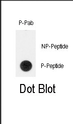 Phospho-TERT (Tyr707) Antibody in Dot Blot (DB)