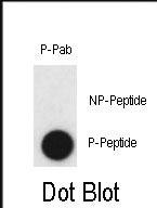 Phospho-Claudin 2 (Tyr224) Antibody in Dot Blot (DB)