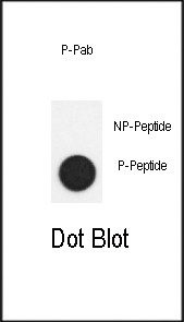 Phospho-SMAD2 (Ser118) Antibody in Dot Blot (DB)